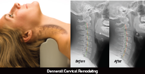 March 6-7, 2026: Module 4. Cervical Rehab