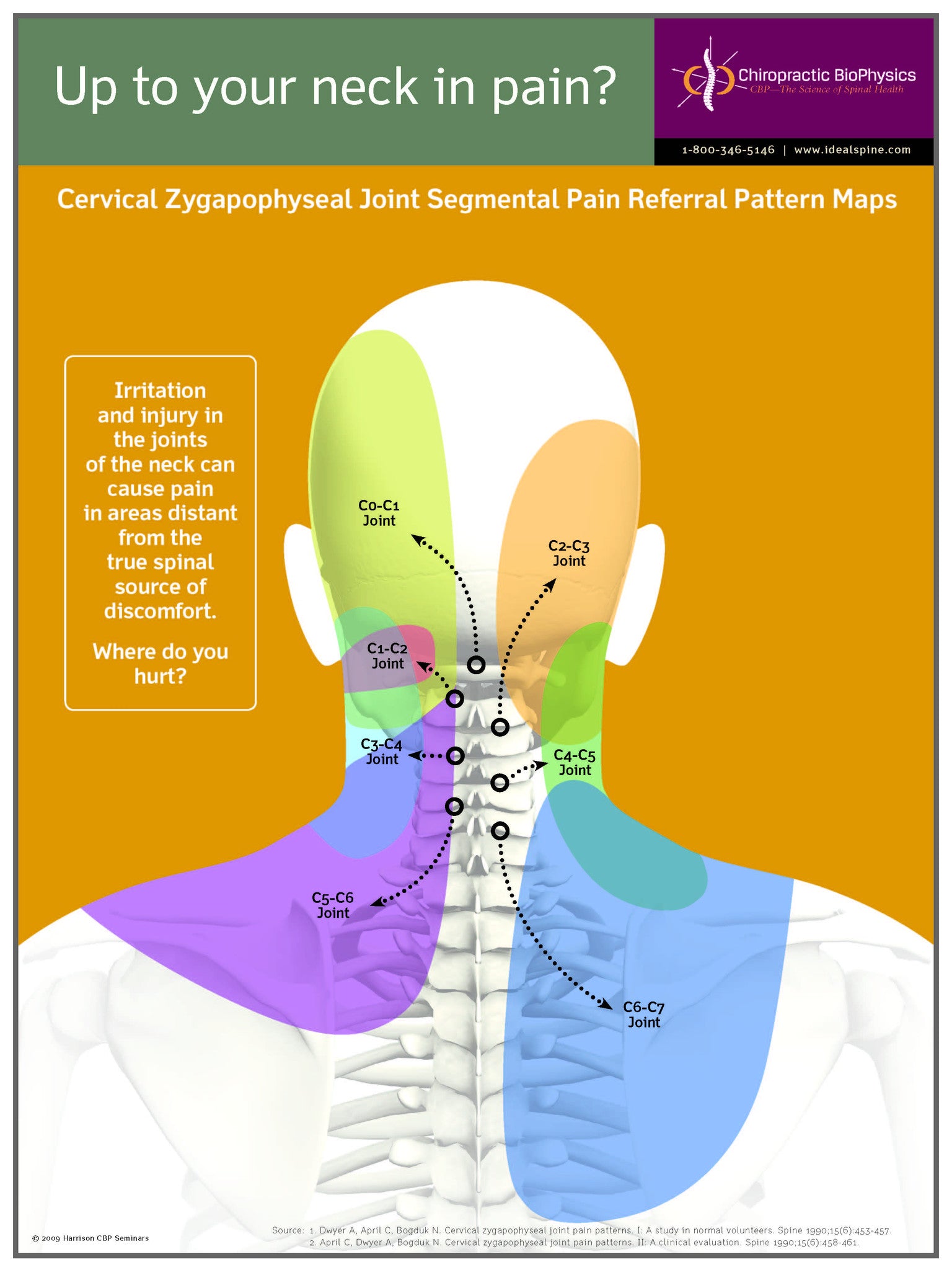 Cervical Neck Pain Map The Cloward Sign...cervical Referral Patterns
