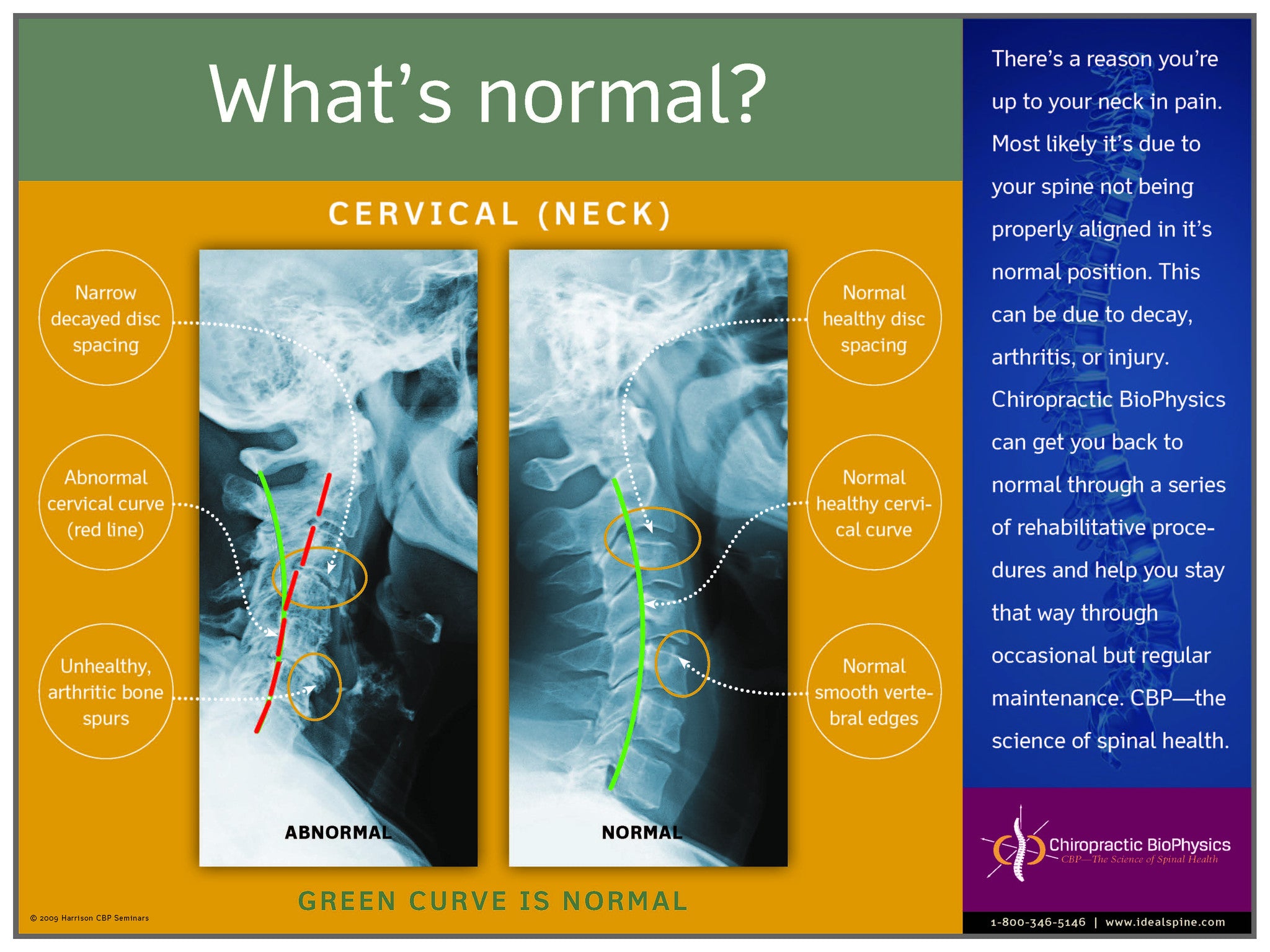 Normal vs. Abnormal Cervical X-Ray – Chiropractic BioPhysics