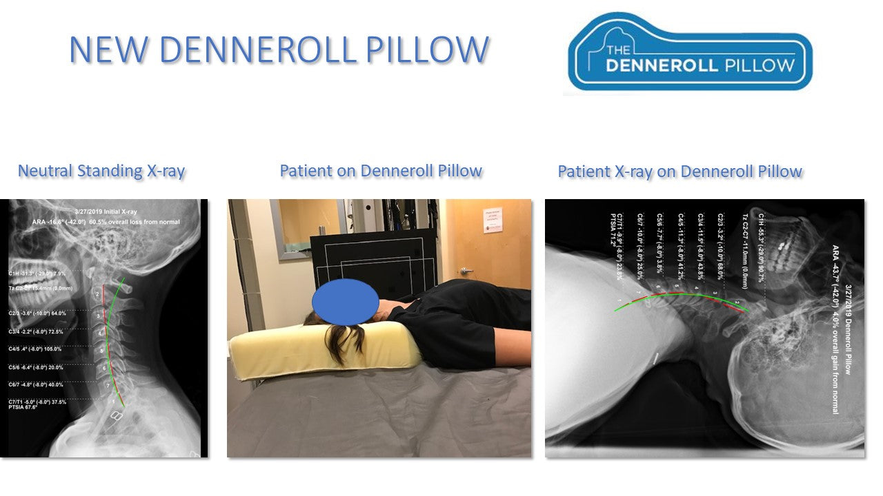 The Denneroll Pillow Chiropractic BioPhysics