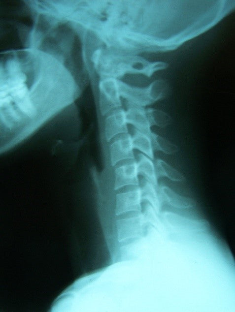 Thoracic-Flex Traction Body Weight